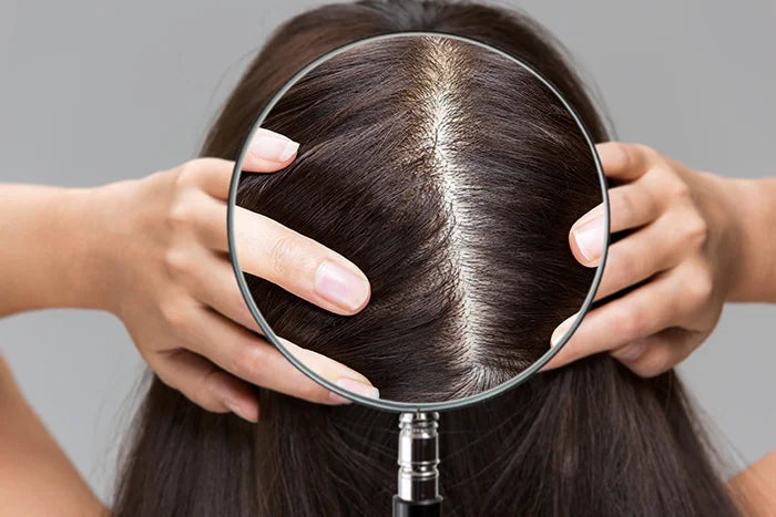 Close-up of scalp under magnifying glass showing part line and scalp condition.