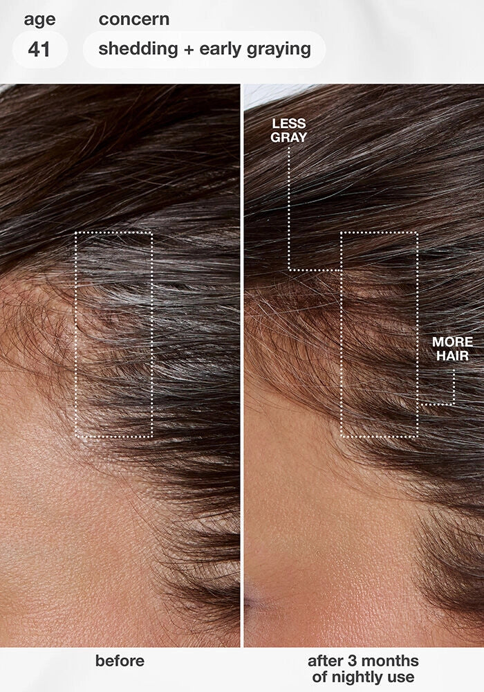 K18 FutureIQ™ Biomimetic Hair Longevity Serum