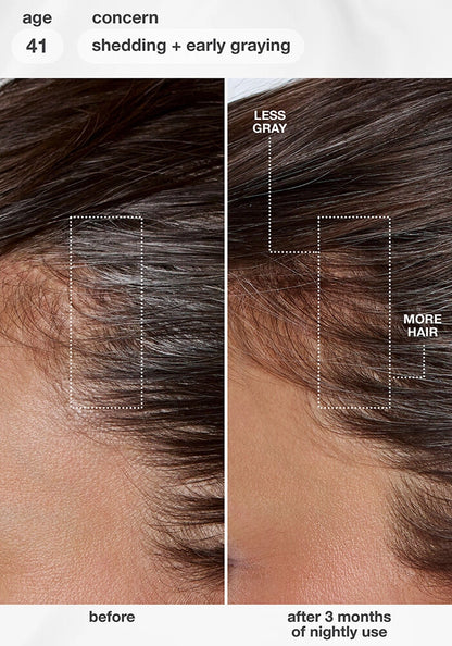 K18 FutureIQ™ Biomimetic Hair Longevity Serum