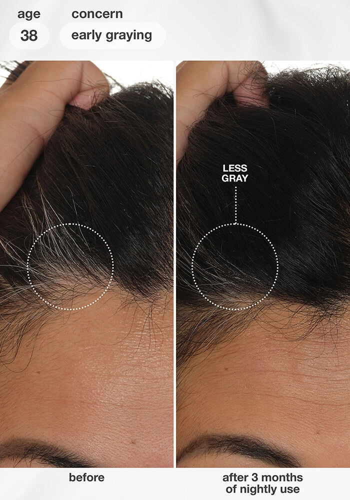 K18 FutureIQ™ Biomimetic Hair Longevity Serum