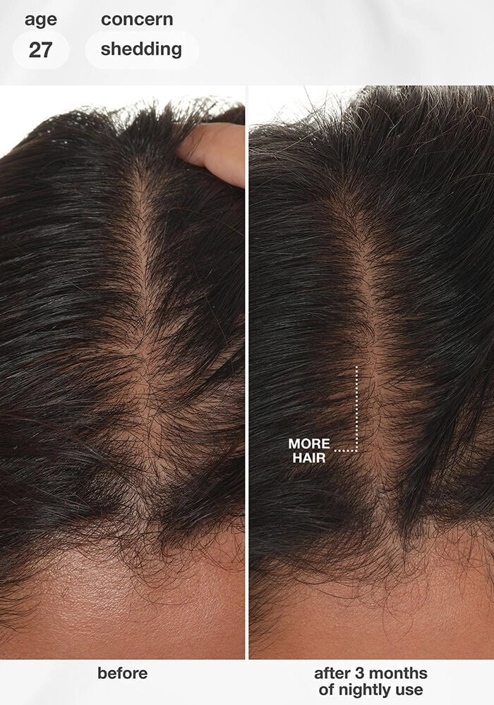 K18 FutureIQ™ Biomimetic Hair Longevity Serum
