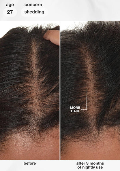 K18 FutureIQ™ Biomimetic Hair Longevity Serum