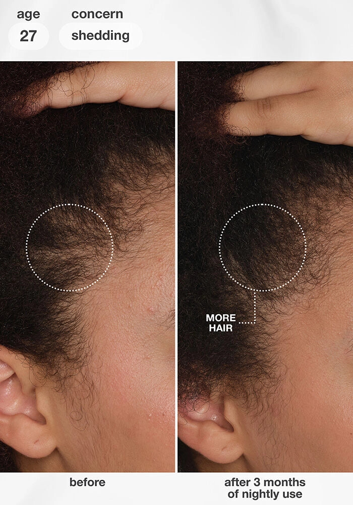 K18 FutureIQ™ Biomimetic Hair Longevity Serum