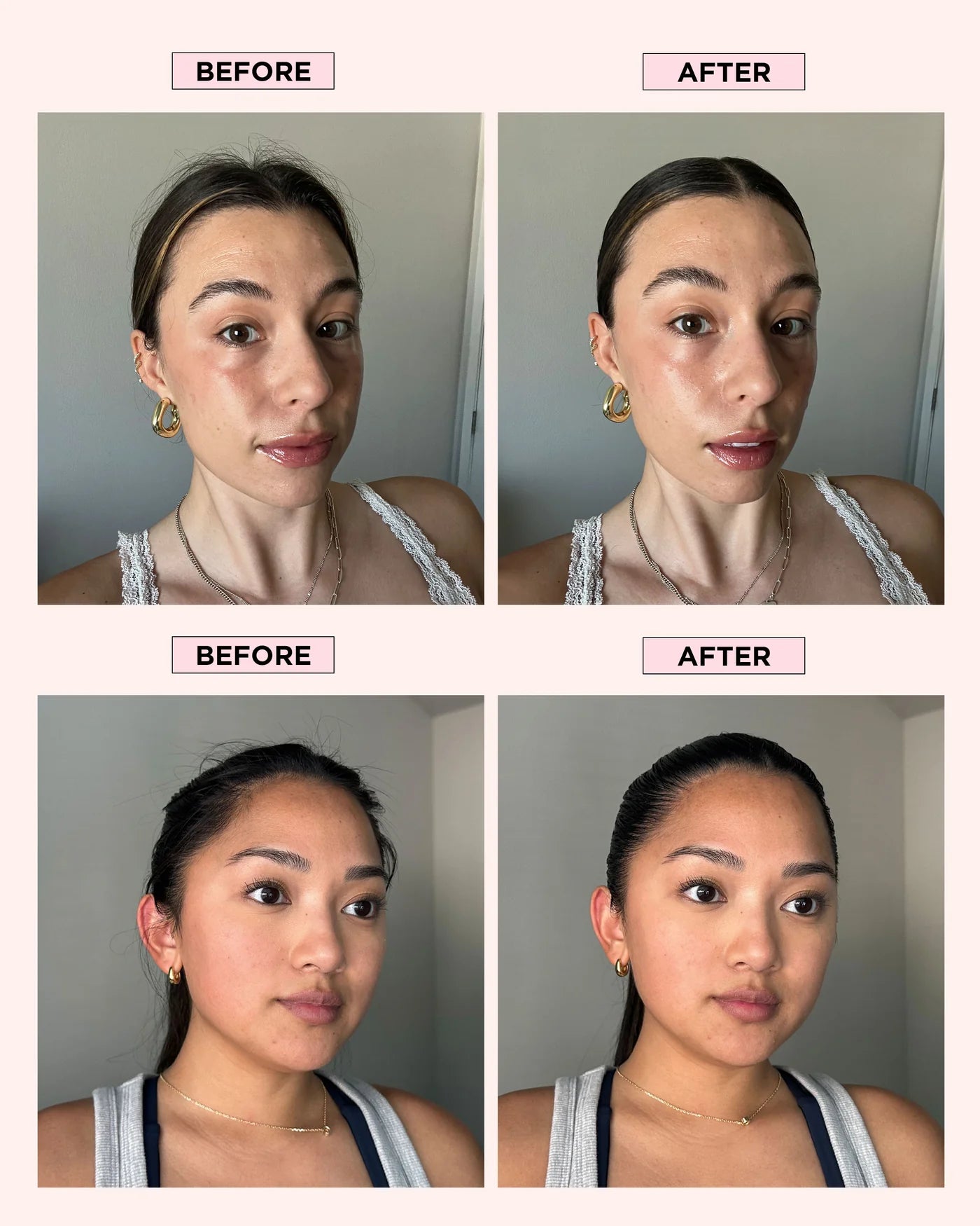 Before and after comparison of two women with a neutral background